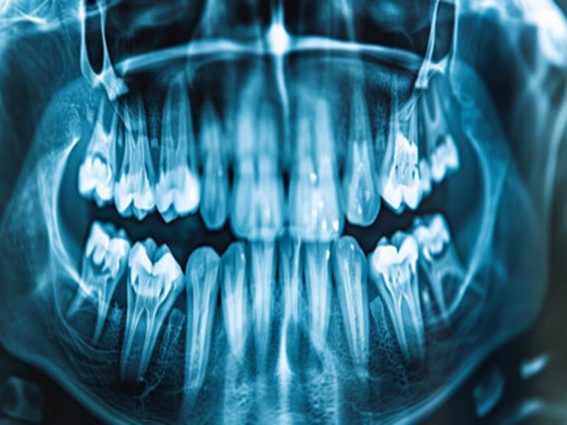 Streamlining Operations with Dental Laboratory Software